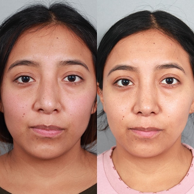Before & After