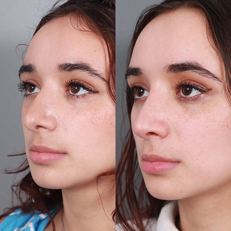 Before & After