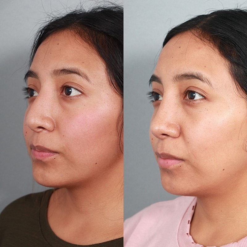 Before & After