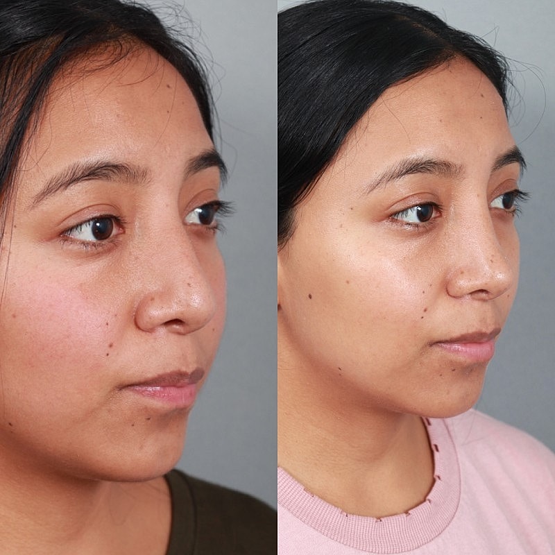 Before & After