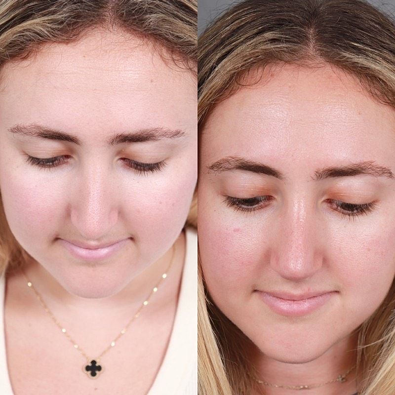 Before & After