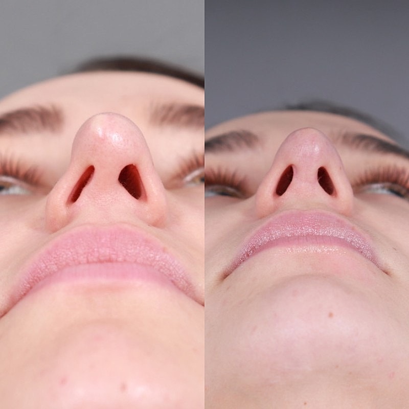 Before & After