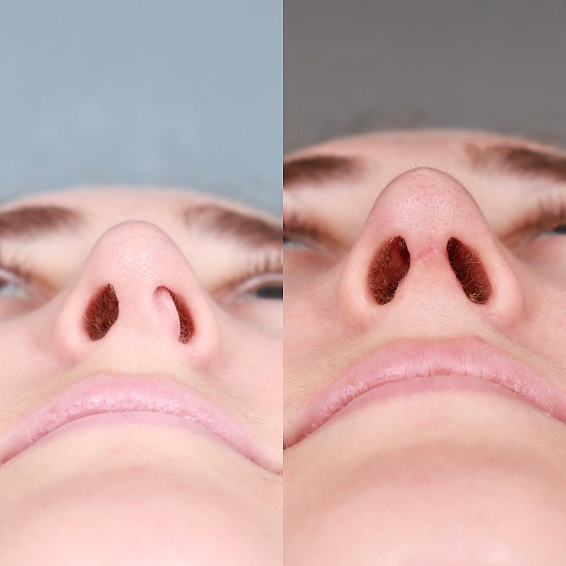 Before & After