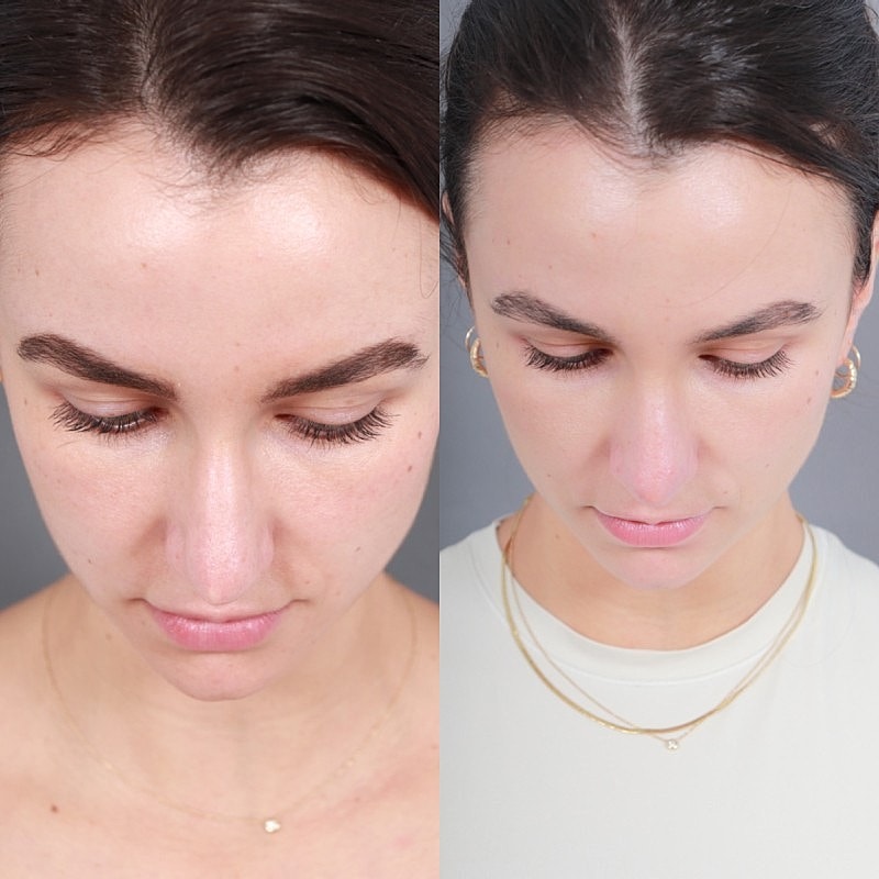 Before & After